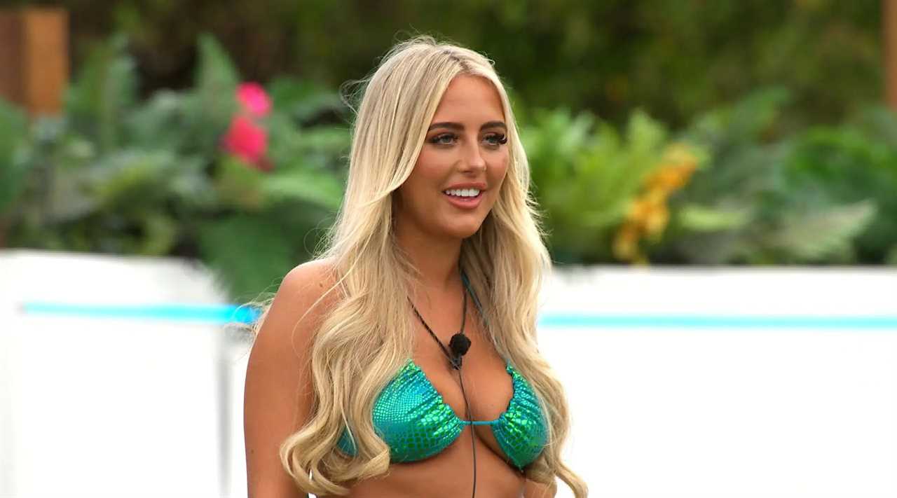 I’m a celebrity dentist and Love Island’s turkey teeth trend is so unhealthy