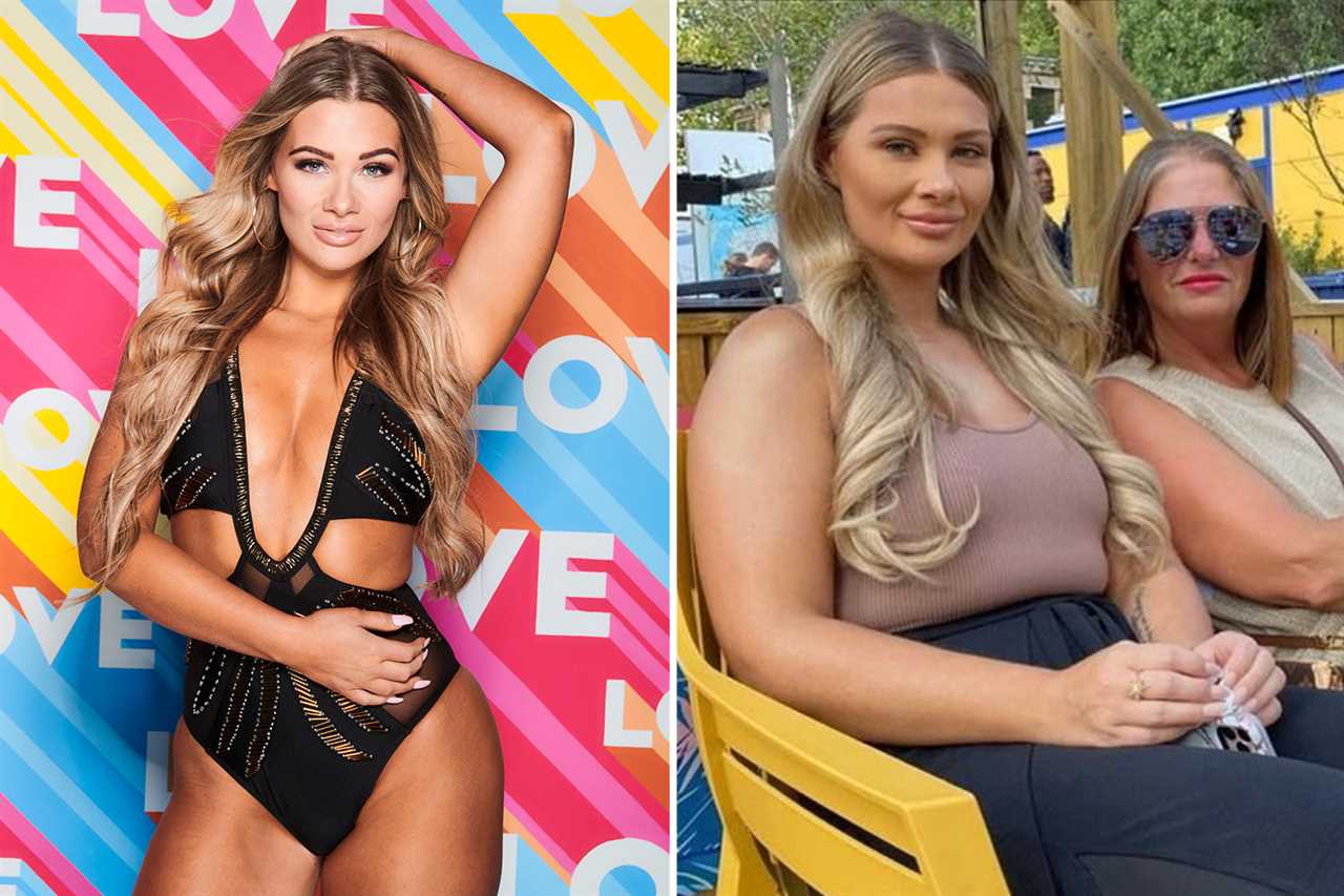 Inside Love Island’s make-unders from stars dissolving fillers to quitting strict diets and ‘wonky’ Turkey boob job