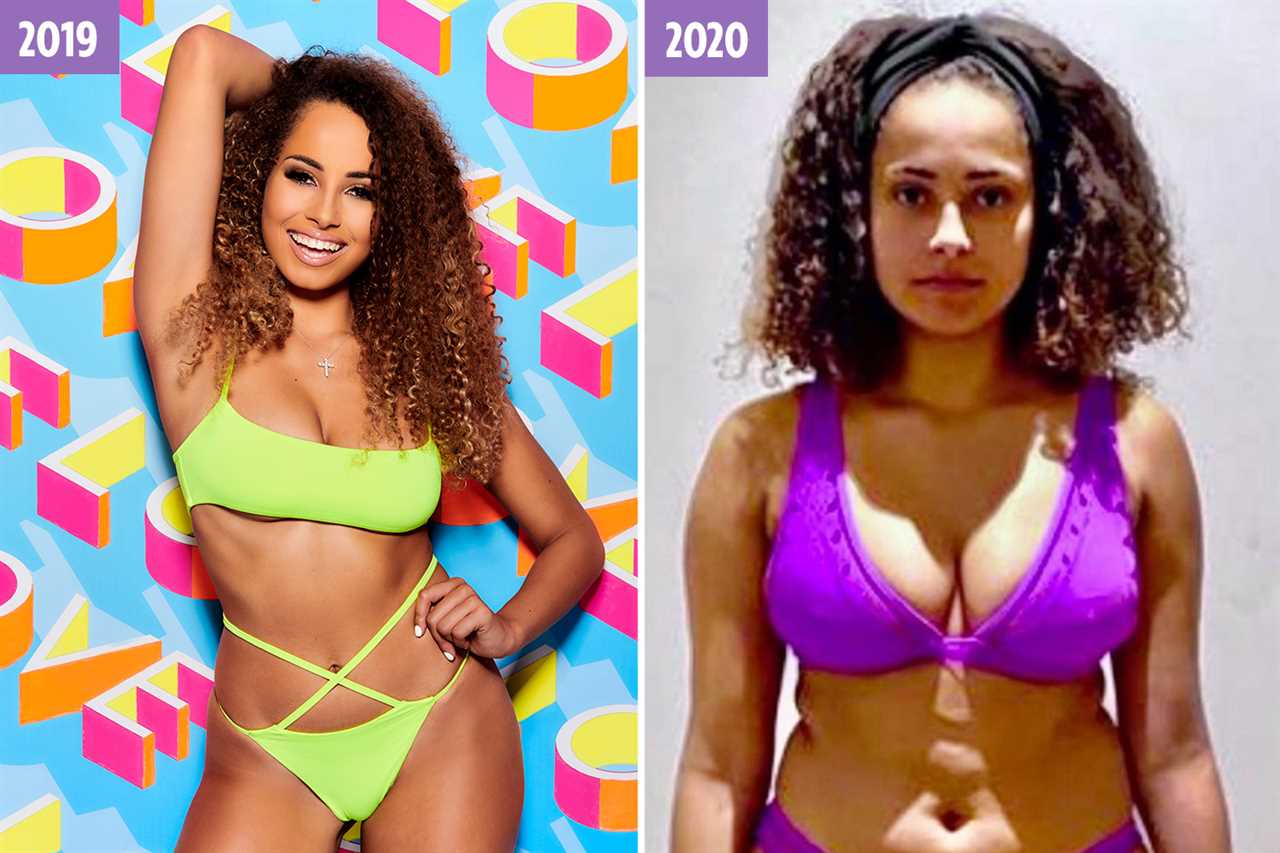 Inside Love Island’s make-unders from stars dissolving fillers to quitting strict diets and ‘wonky’ Turkey boob job