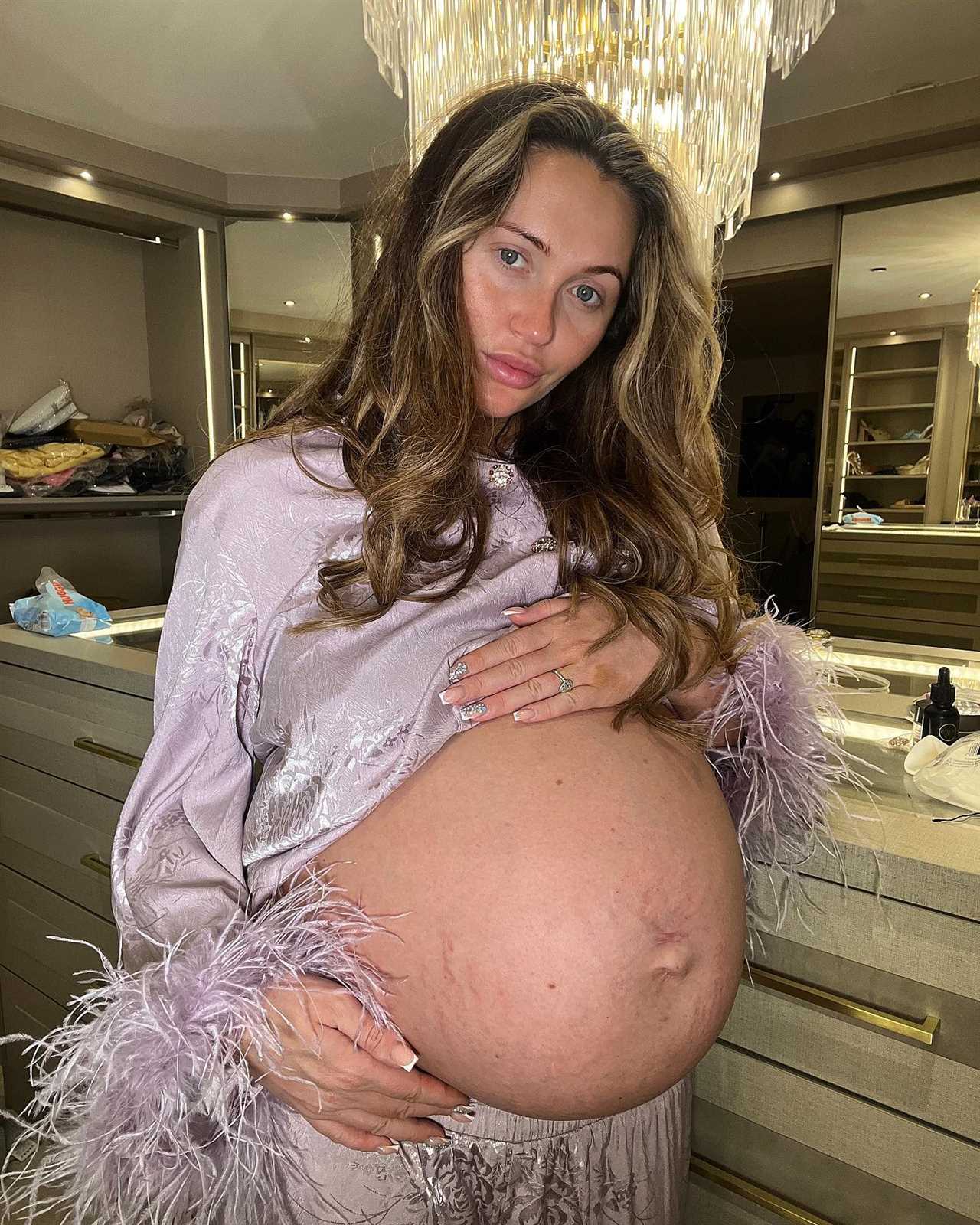 Charlotte Dawson praised by fans as she shows off ‘real pregnancy body’ and says she’s ‘proud’ of her stretch marks