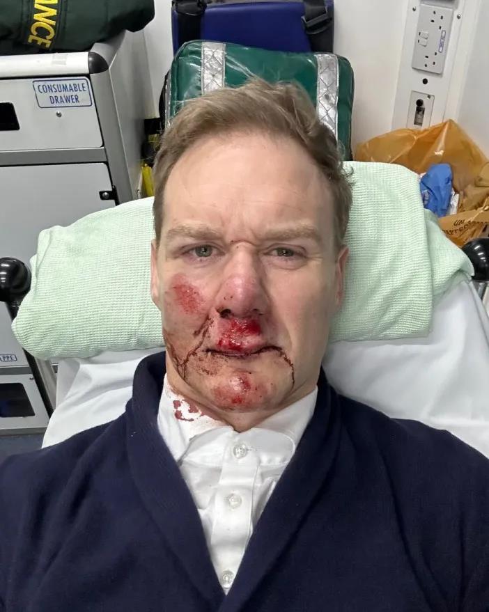 Dan Walker gives shock medical update after near-death cycling accident