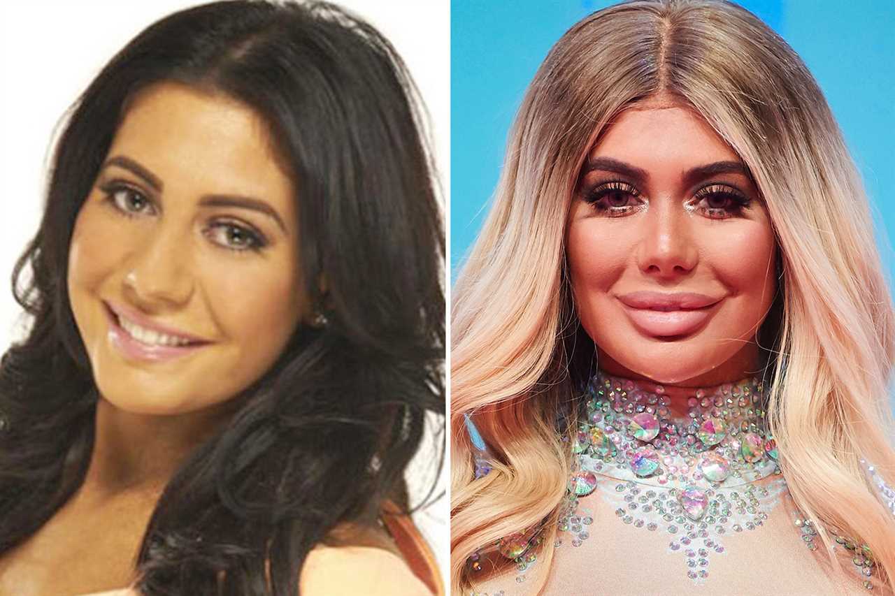 Geordie Shore cast’s changing faces – from shaved jaw to ‘head chiselling’ and regrets over ‘elephant man’ lip filler
