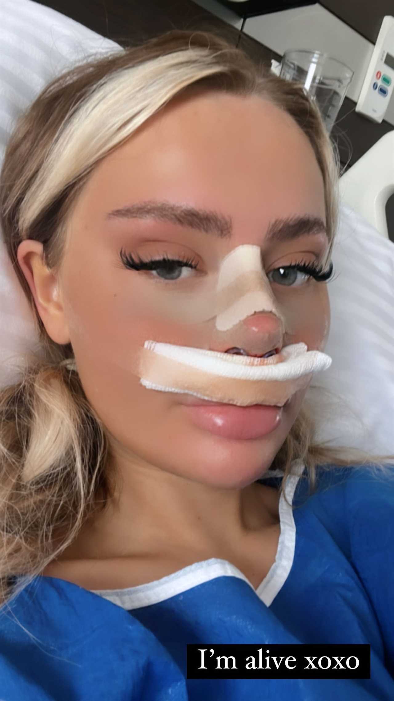 Stephen Bear’s girlfriend Jessica reveals she’s having MORE surgery after showing off results of her nose job