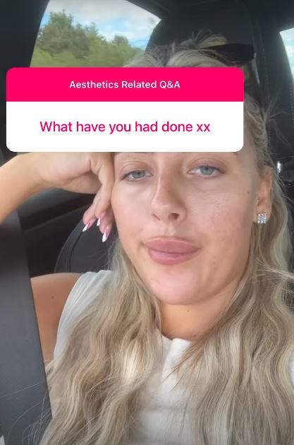Love Island winner Jess Harding reveals exactly what she’s had done to her face including lip and cheek fillers