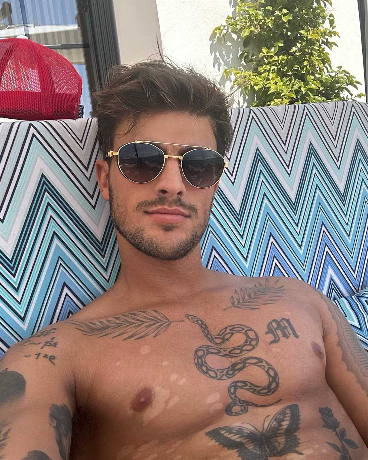 Love Island star embraces his 'real skin' with reveal of skin condition