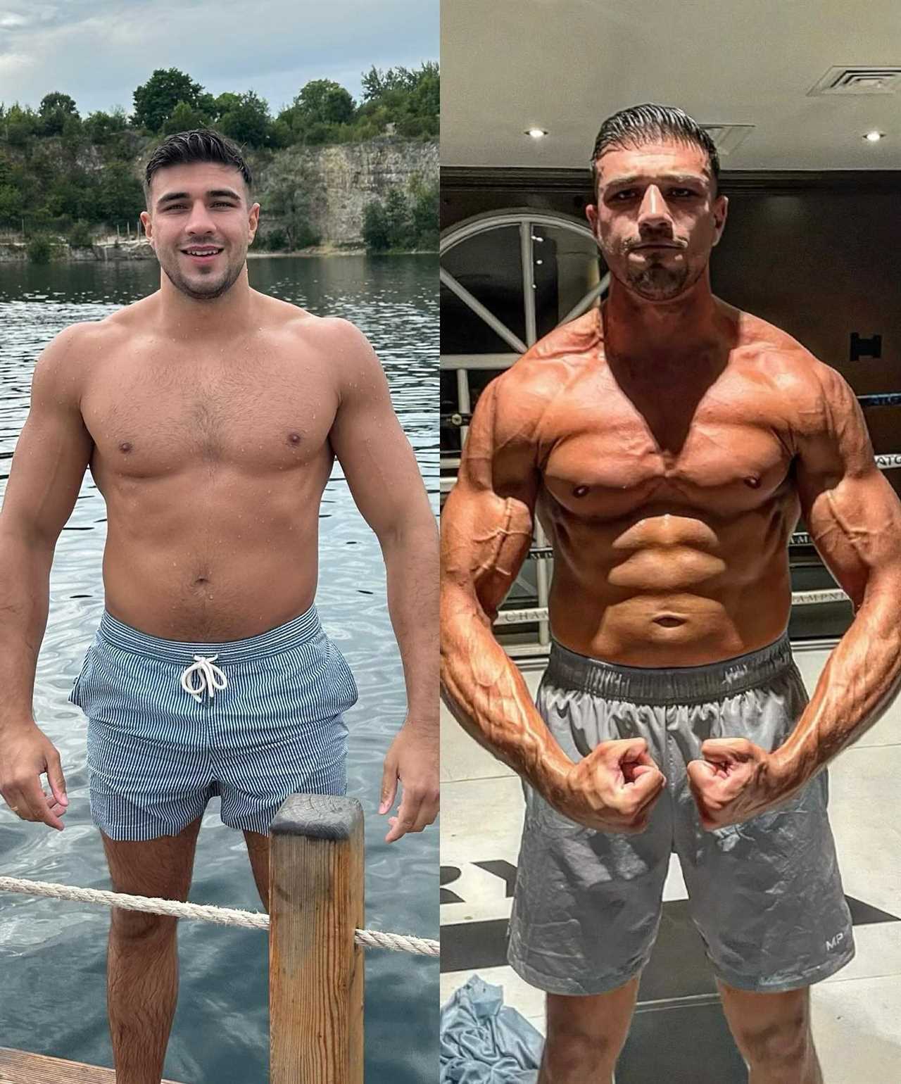 Love Island Stars' Shocking Body Transformations: From Ripped Physiques to Perfect Boob Jobs