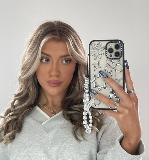 Love Island Star Molly Marsh Sparks Plastic Surgery Rumors with New Video