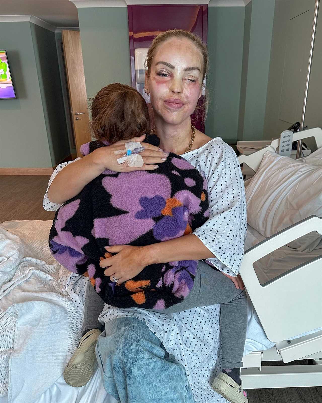 Katie Piper undergoes surgery to save her eye and urges trolls to back off