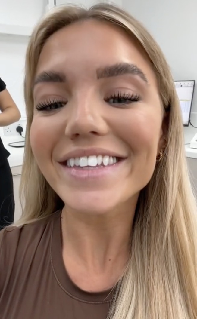 Love Island Star Molly Smith Faces Backlash for Dental Transformation