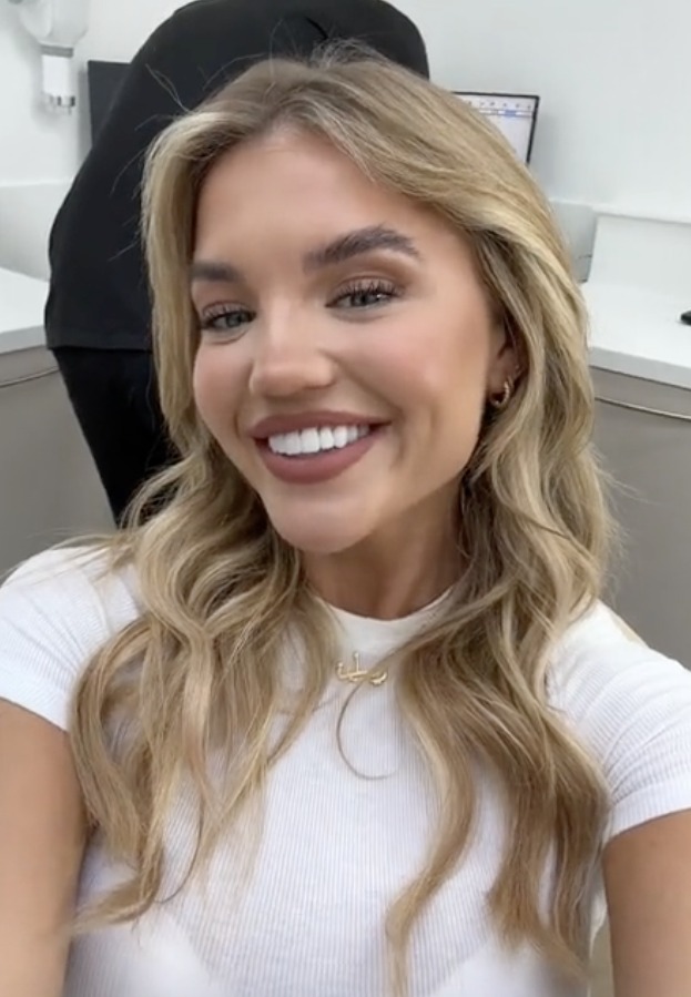 Love Island Star Molly Smith Faces Backlash for Dental Transformation