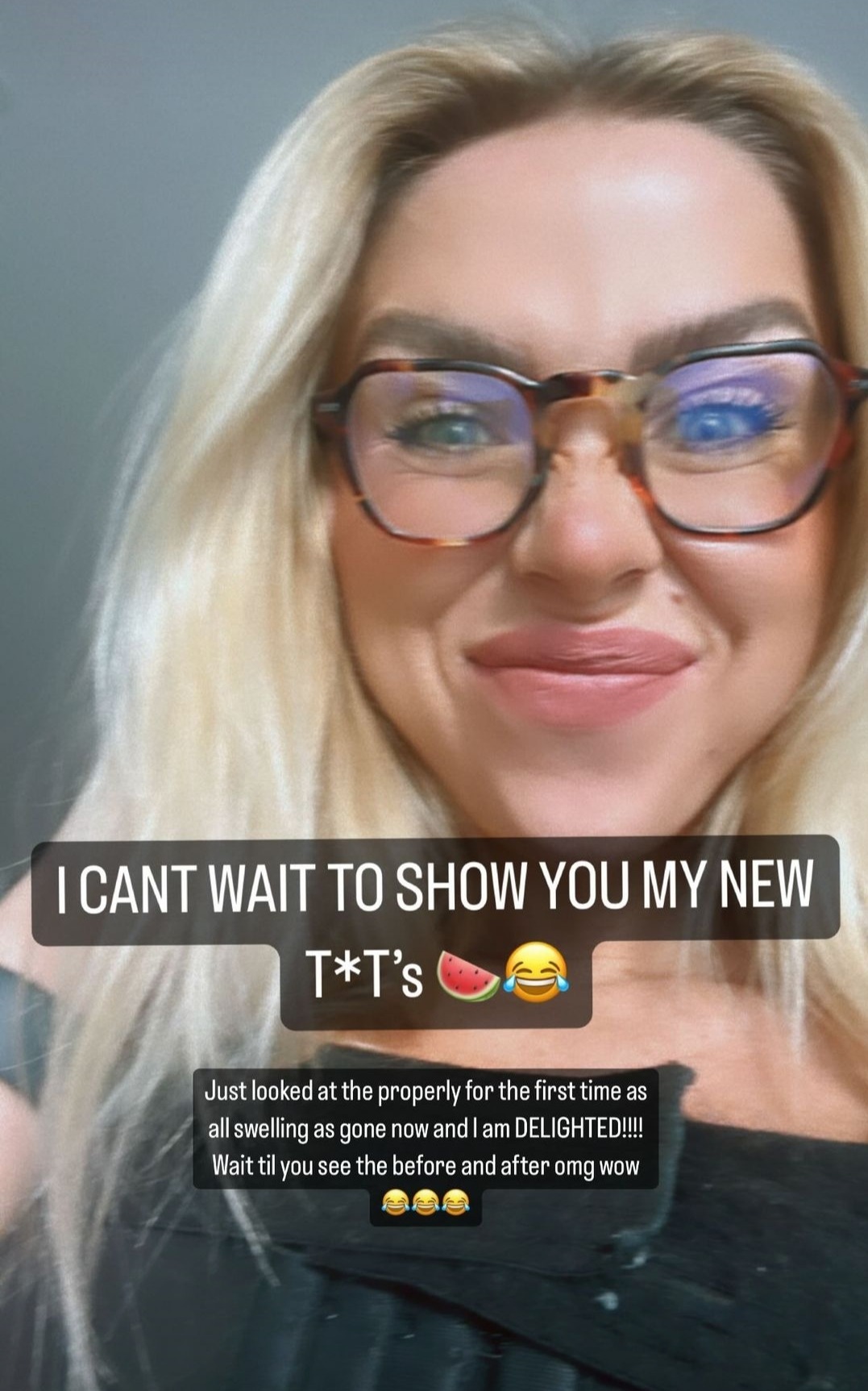 Gabby Allen reveals second boob job after first one goes wrong