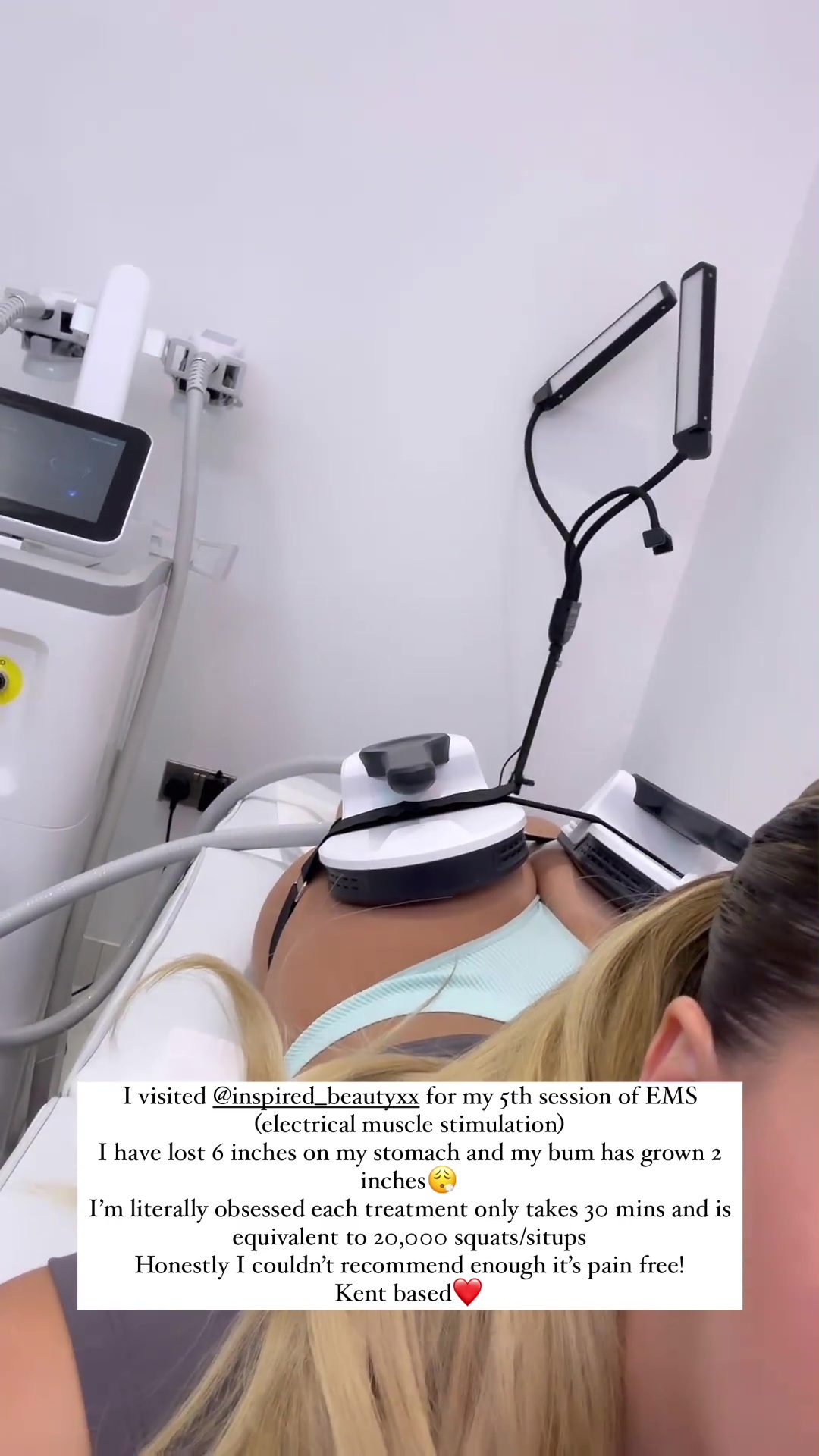 Love Island's Ella Barnes Reveals Results of 'Bum Lift'