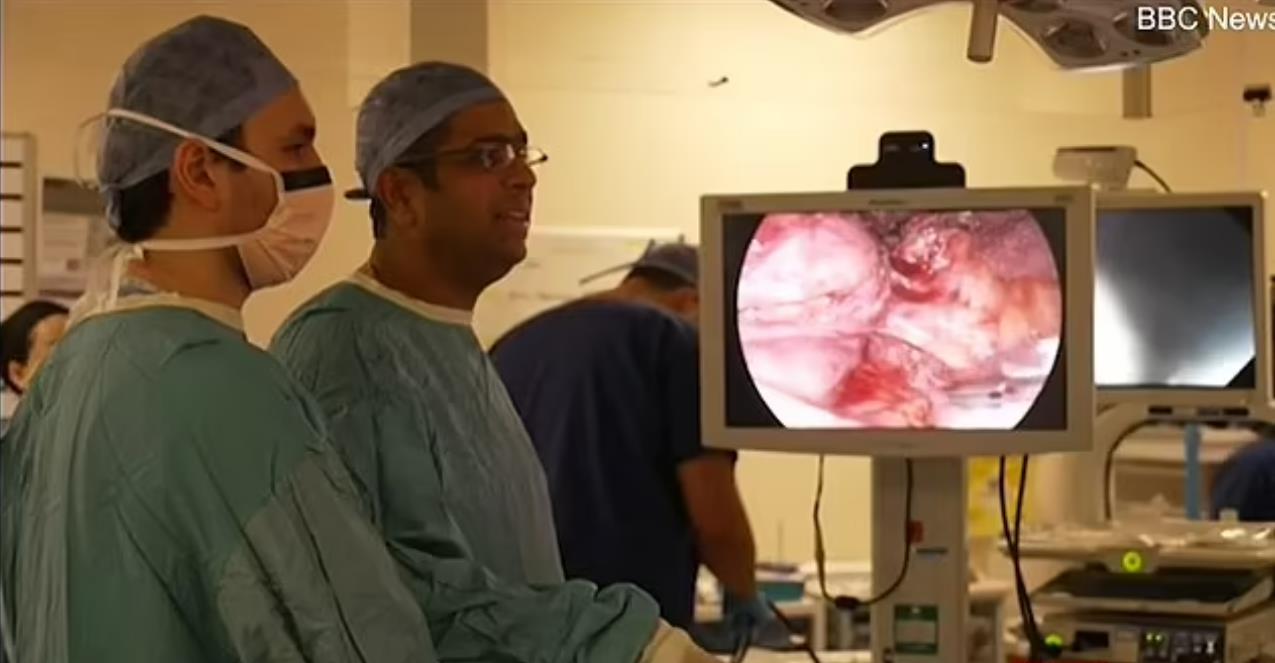 BBC Breakfast viewers complain about airing 'graphic' surgery scenes