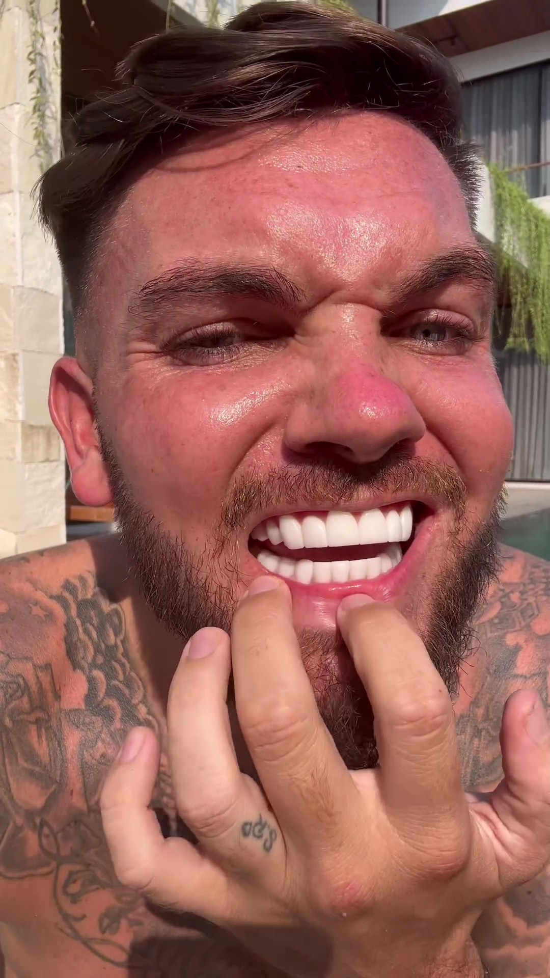 Furious Geordie Shore Star Claps Back at Trolls Over £6k Turkey Teeth