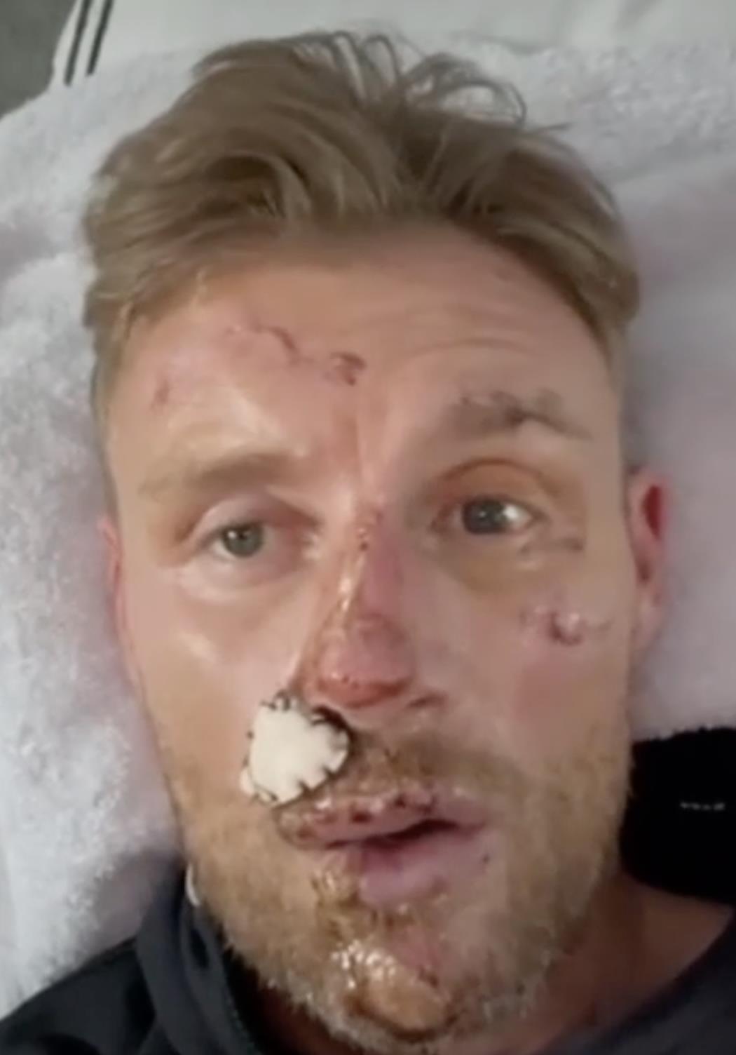 Freddie Flintoff Fans in Tears as Star's Injuries Revealed on New Show