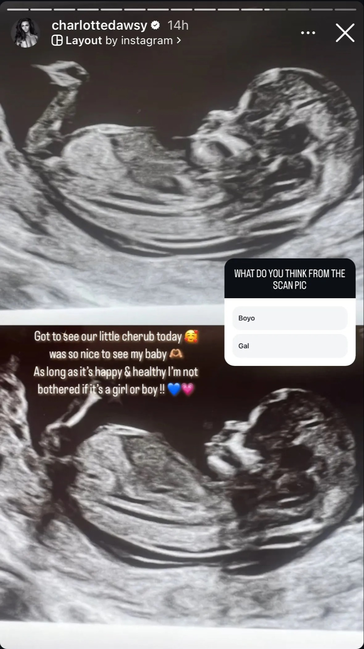 Pregnant Charlotte Dawson shares baby scan after snubbing fiancé Matt over sexting scandal