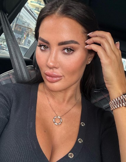 TOWIE's Yazmin Oukhellou reveals new look after dissolving '10 years of filler'