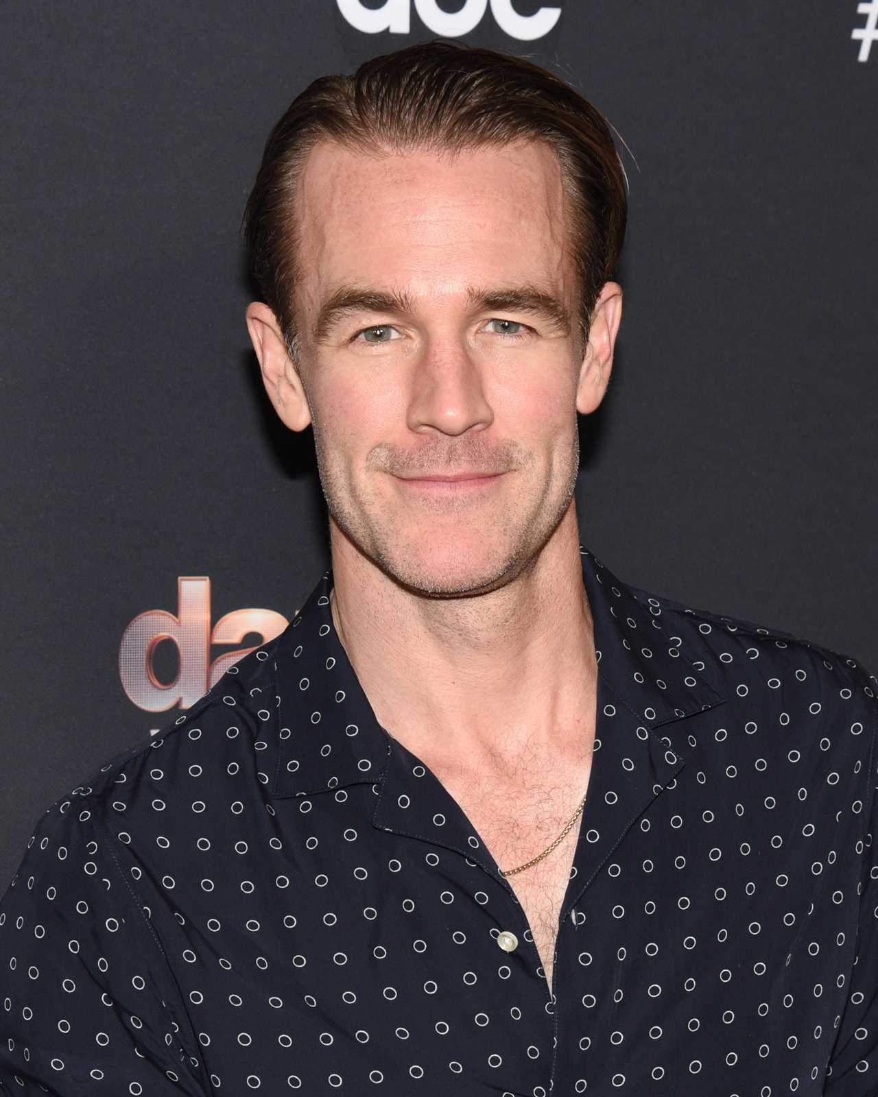 Dawson’s Creek Star James Van Der Beek Opens Up About Vasectomy Before Cancer Diagnosis