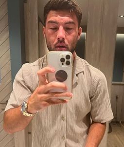 Love Island winner Liam Reardon shares shocking photo of swollen face after food poisoning nightmare