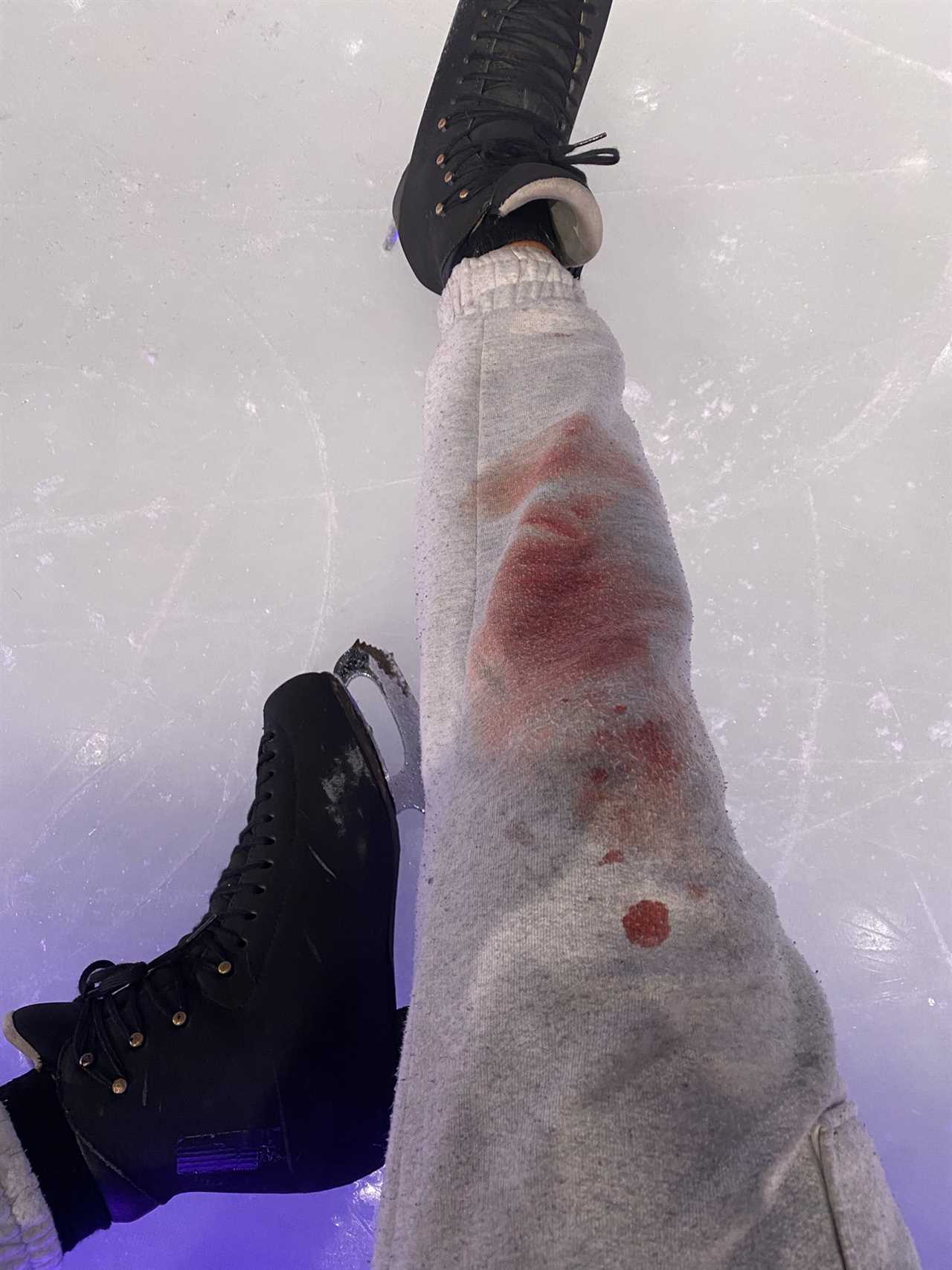 Dancing On Ice star Colin Grafton suffers nasty rehearsal accident ahead of show