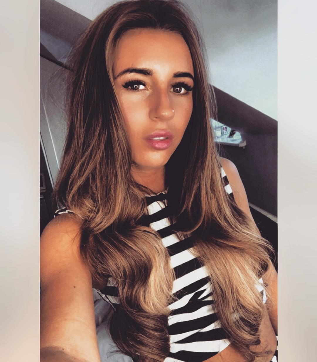 Dani Dyer reveals details of plastic surgery on her podcast