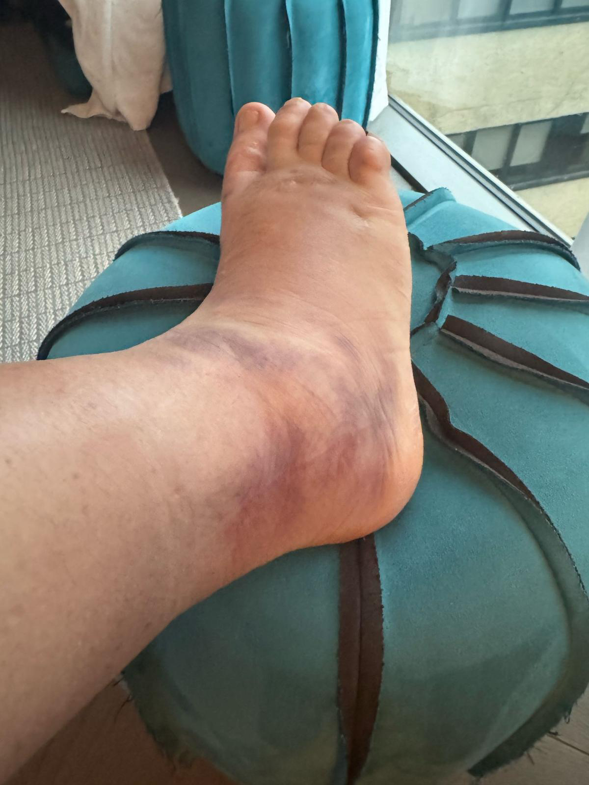 Legal Action Unfolds in Strictly Controversy Amid Injury Dispute