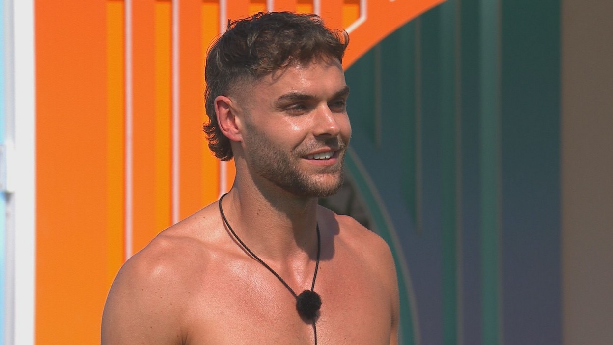 Analysis: Love Island Star's Hair Transplant at 24 Sparks Debate on Beauty Standards