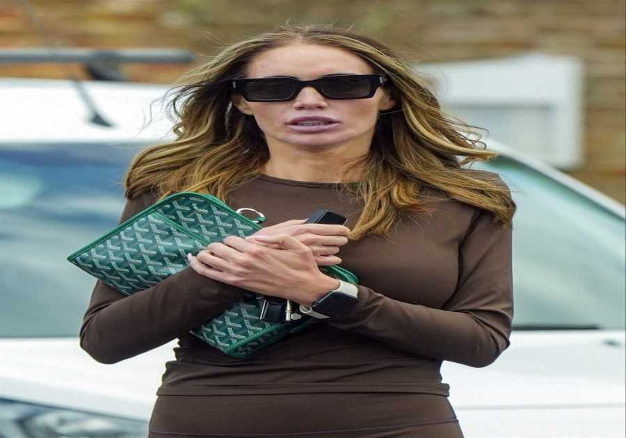 Amy Childs Removes Engagement Ring Amid Wedding Cancellation and Weight Loss Revelation
