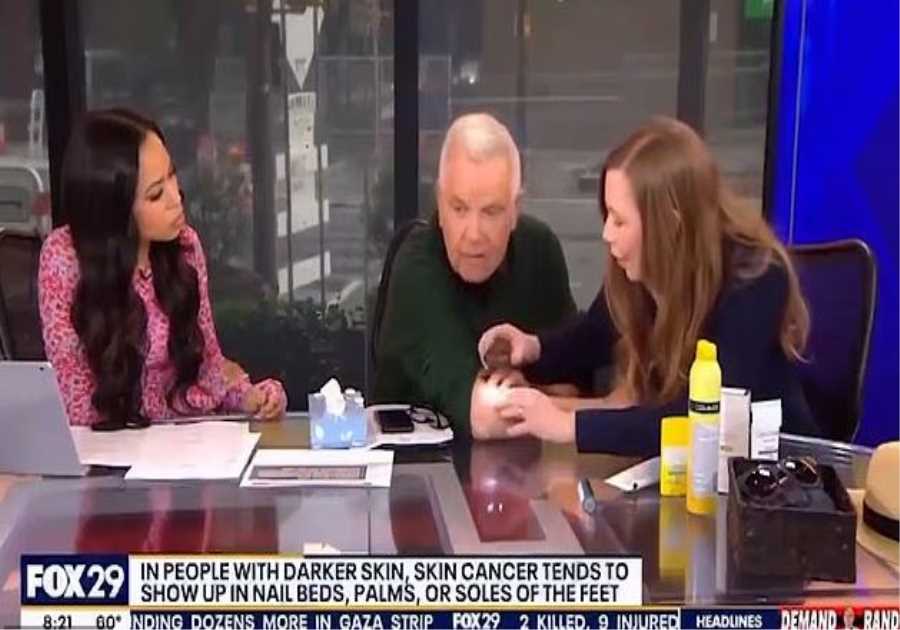 Unforeseen Discovery: TV Host Confronts Skin Cancer Diagnosis Live